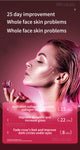 Facial Lifting Device LED Photon Therapy Facial Slimming Vibration Massager Double Chin V Face Shaped Cheek Lift Belt Machine - TimelessGear9