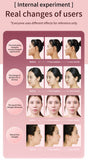 Facial Lifting Device LED Photon Therapy Facial Slimming Vibration Massager Double Chin V Face Shaped Cheek Lift Belt Machine - TimelessGear9